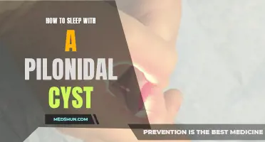 Tips for Getting a Good Night's Sleep Despite a Pilonidal Cyst