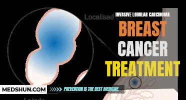 Advancements in Invasive Lobular Carcinoma Breast Cancer Treatment: A Promising Road Ahead