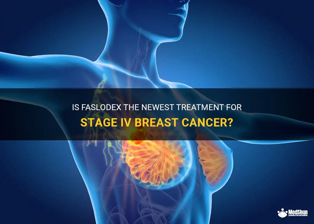 is fasladex the newest treatment of stage iv breast cancer