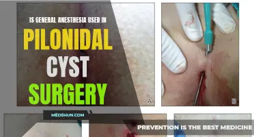 Exploring the Role of General Anesthesia in Pilonidal Cyst Surgery