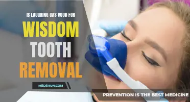 The Benefits of Laughing Gas for Wisdom Tooth Removal