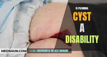 Understanding Pilonidal Cyst: Is it Considered a Disability?