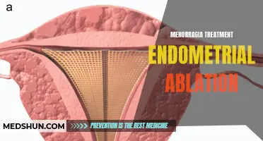 Exploring the Benefits and Effectiveness of Endometrial Ablation in Menorragia Treatment