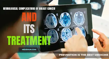 Understanding the Neurological Complications of Breast Cancer and its Treatment