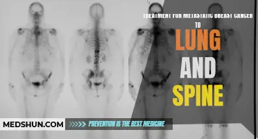 The Latest Advances in Treatment for Metastatic Breast Cancer to the Lung and Spine