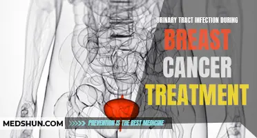 The Connection Between Urinary Tract Infections and Breast Cancer Treatment
