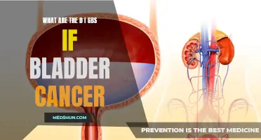 Understanding the Different Stages of Bladder Cancer: A Guide to the D I GBS