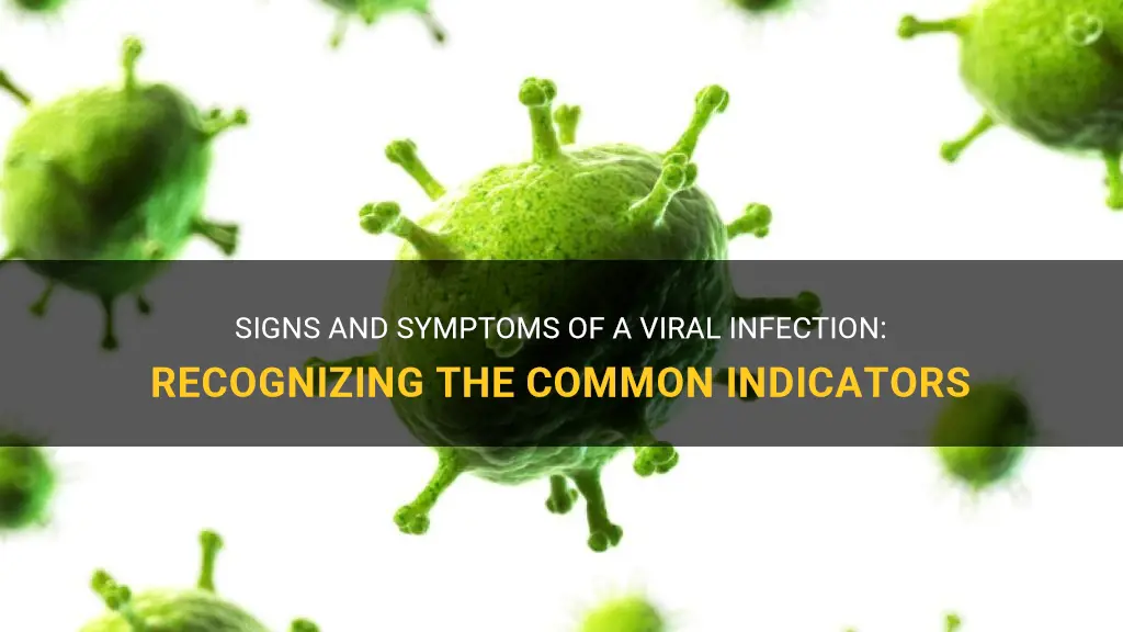 what are the symptoms of viral infection