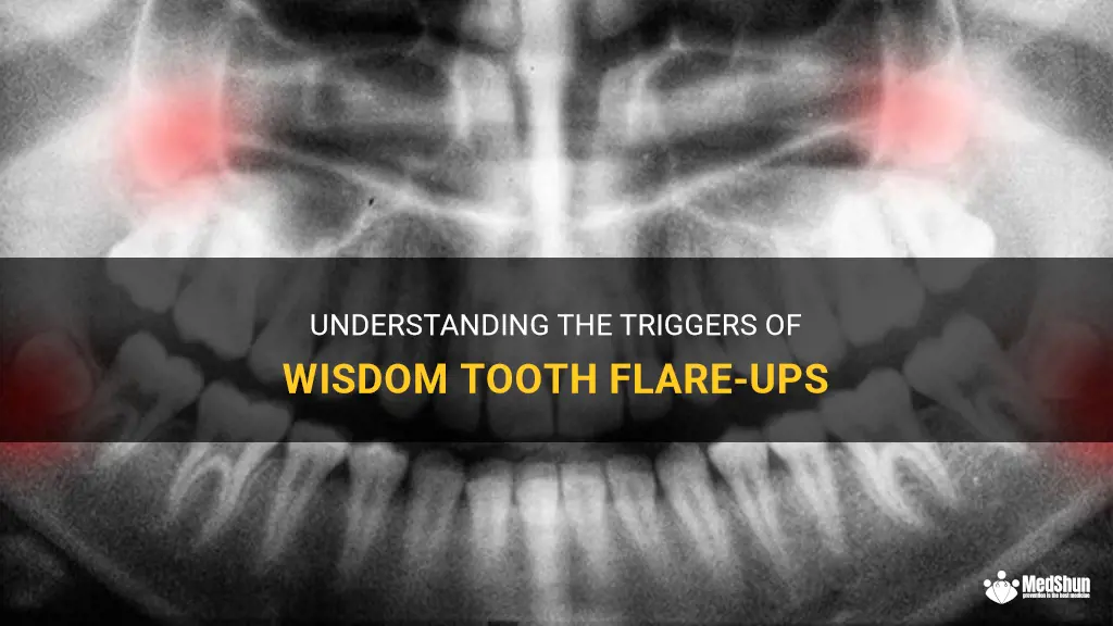 Understanding The Triggers Of Wisdom Tooth Flare-Ups | MedShun