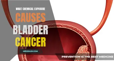Understanding the Link: Chemical Exposure and Bladder Cancer