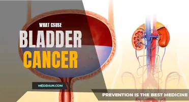 Understanding the Causes of Bladder Cancer: What You Need to Know