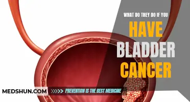 Understanding the Treatment Options for Bladder Cancer