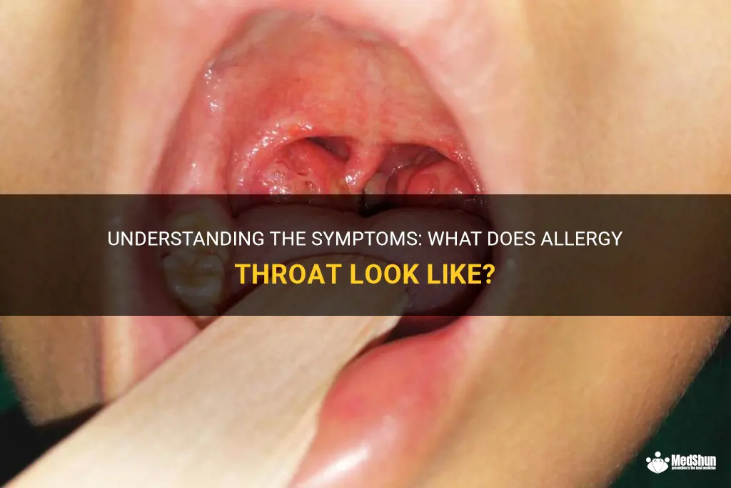 what does allergy throat look like