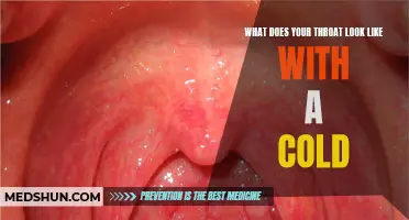 How a Cold Affects the Appearance of Your Throat
