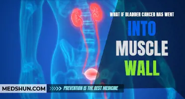 When Bladder Cancer Invades the Muscle Wall: Understanding Prognosis and Treatment Options