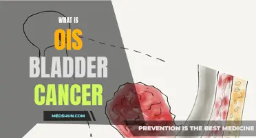 Understanding Bladder Cancer: Causes, Symptoms, and Treatments