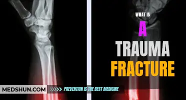 Understanding Trauma Fractures: Causes, Symptoms, and Treatments
