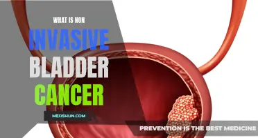 Understanding Non-Invasive Bladder Cancer: A Comprehensive Guide