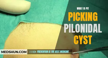 Understanding Pit Picking: Exploring the Basics of Pilonidal Cysts