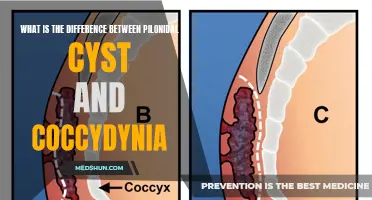 Understanding the Distinction Between Pilonidal Cyst and Coccydynia