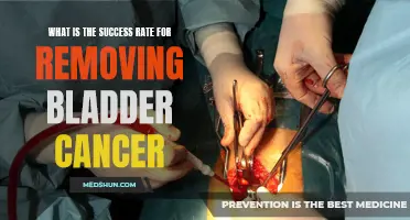 Unraveling the Success Rate for Removing Bladder Cancer: A Comprehensive Analysis