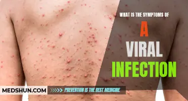 Understanding the Common Symptoms of Viral Infections