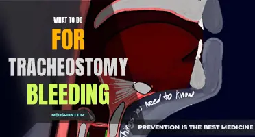 Managing Tracheostomy Bleeding: Essential Steps to Take