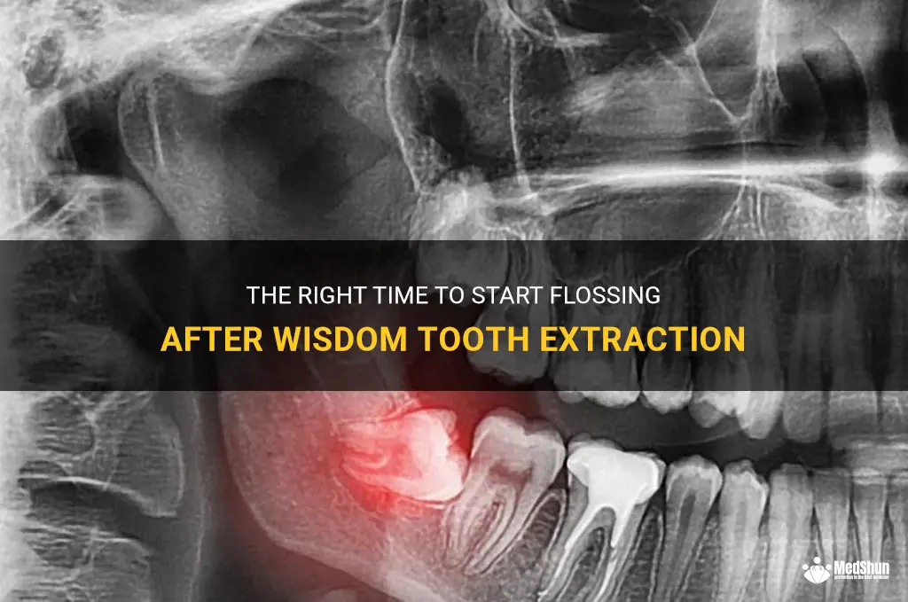 The Right Time To Start Flossing After Wisdom Tooth Extraction | MedShun