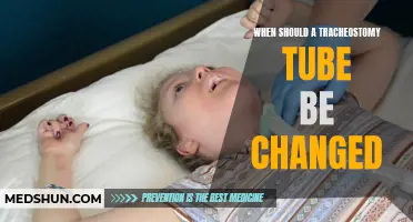 When Is the Right Time to Change a Tracheostomy Tube?