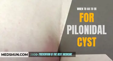 The Importance of Recognizing When to Go to the ER for a Pilonidal Cyst