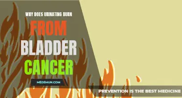 Understanding the Causes of Burning Sensation During Urination in Bladder Cancer Patients