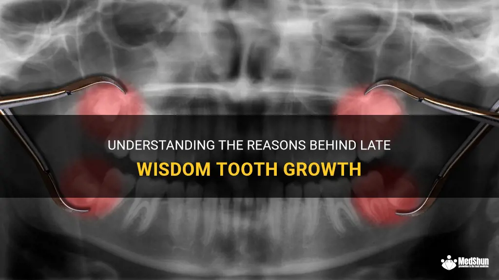 Understanding The Reasons Behind Late Wisdom Tooth Growth | MedShun