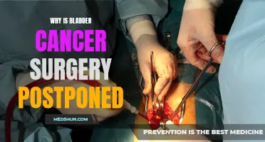 The Importance of Postponing Bladder Cancer Surgery: A Comprehensive Analysis
