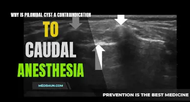 Understanding Pilonidal Cysts: Why They Pose a Contraindication to Caudal Anesthesia