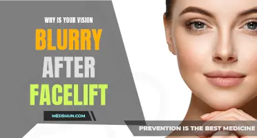 Why Does Your Vision Become Blurry After a Facelift?