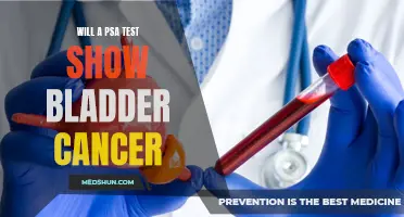 Can a PSA Test Help Detect Bladder Cancer?