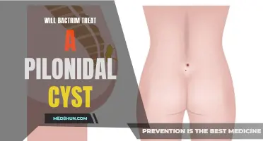 Can Bactrim effectively treat a pilonidal cyst?