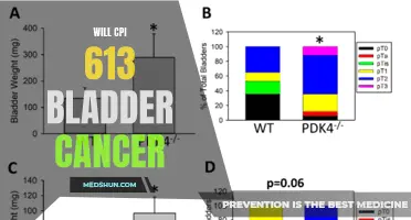 CPI-613: A Promising Treatment Option for Bladder Cancer