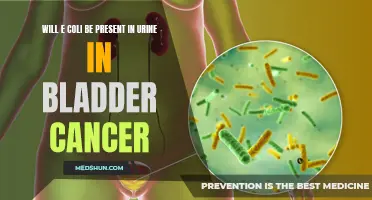 The Link Between Bladder Cancer and E. coli Presence in Urine: A comprehensive analysis