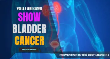 Does a Urine Culture Show Bladder Cancer?