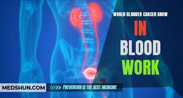 Understanding the Role of Blood Work in Detecting Bladder Cancer