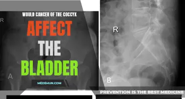 How Does Cancer of the Coccyx Affect the Bladder?